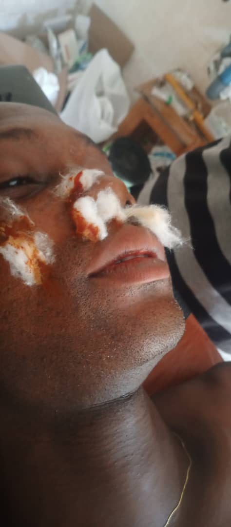 Three Osun Amotekun operatives brutally injured as armed hoodlums attack command