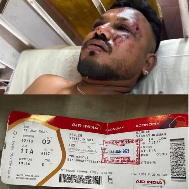 One passenger survives devastating Air India plane crash which killed 241 persons