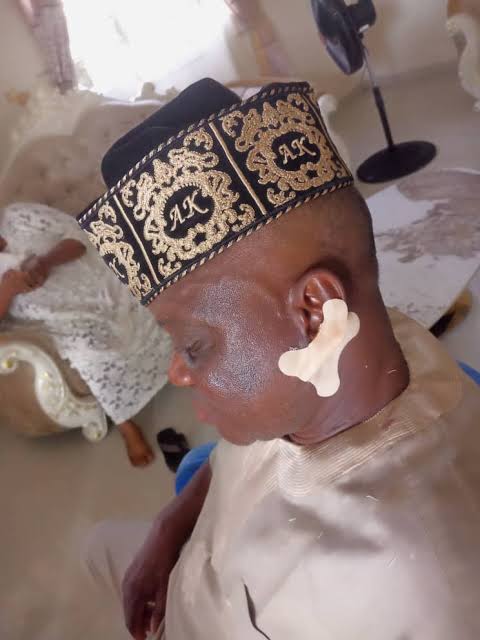 Ear bitten, crown removed as community leader allegedly attack Ondo monarch over sitting arrangement
